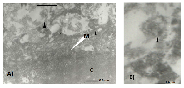 **Figura 4.25. Células tratadas con propóleo (0.5 mg/ml) dos horas antes de la infección con Aujeszky. A. partículas virales (<U+25B2>) en el citoplasma de la célula (C), también se observó una estructura densa y grumosa ubicada en la membrana celular (M) en la que las partículas virales quedan atrapadas. B. Micrografía amplificada de la figura A en la que se observa posible deterioro en la superficie de una partícula viral de Aujeszky ubicada fuera de la membrana plasmática de la célula infectada.**